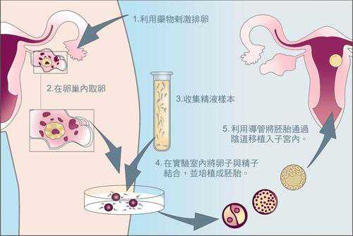 如何判断供卵机构靠不靠谱,广州供卵试管，如何选择靠谱助孕机构？