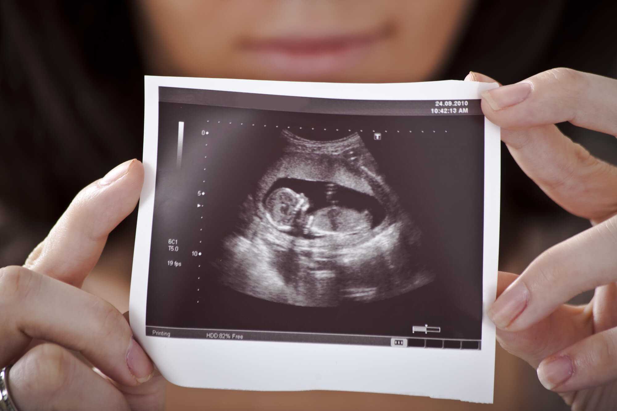 苏州大学附属第一医院做三代试管供卵生男孩费用多少，25万够吗